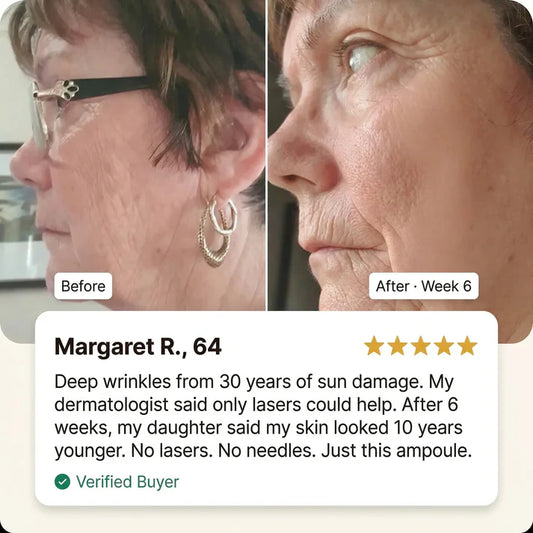 Korean Collagen Lift Ampoule™