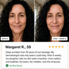 Deep Collagen Lip & Face Plumping Serum