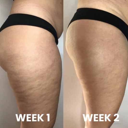 Belavines Cellulite Oil